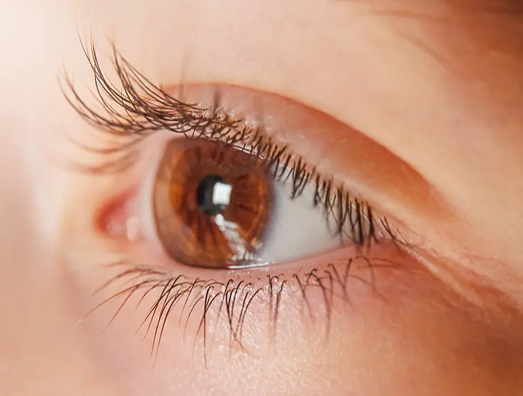 Contactlenzen voor myopiemanagement